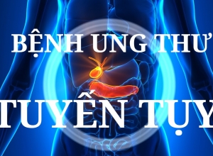 Làm sao để phát hiện sớm ung thư tuyến ?